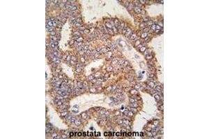 Image no. 2 for anti-Transient Receptor Potential Cation Channel, Subfamily M, Member 8 (TRPM8) (C-Term) antibody (ABIN360715)