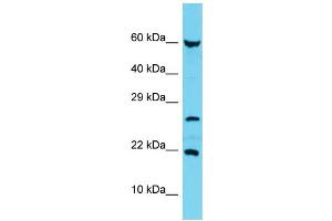 Host: Rabbit Target Name: C17orf102 Sample Type: MCF7 Whole Cell lysates Antibody Dilution: 1. (C17orf102 Antikörper  (Middle Region))
