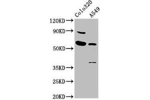 Western Blot Positive WB detected in: Colo320 whole cell lysate, A549 whole cell lysate All lanes: EBF3 antibody at 5. (EBF3 Antikörper  (AA 416-530))