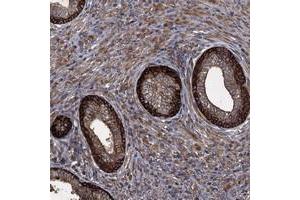 Immunohistochemical staining of human prostate with TXNDC11 polyclonal antibody  shows distinct cytoplasmic positivity in glandular cells. (TXNDC11 Antikörper)