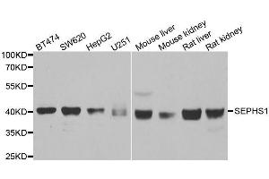Western blot analysis of extracts of various cell lines, using SEPHS1 antibody.