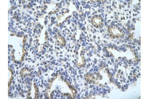 Rabbit Anti-TRA2B Antibody       Paraffin Embedded Tissue:  Human alveolar cell   Cellular Data:  Epithelial cells of renal tubule  Antibody Concentration:   4. (TRA2B Antikörper  (Middle Region))