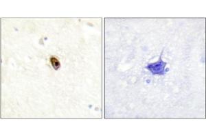Immunohistochemistry analysis of paraffin-embedded human brain tissue using AurB/C (Phospho-Thr236/202) antibody. (Aurora Kinase C Antikörper  (pThr202, pThr236))
