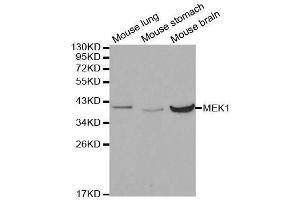 Western blot analysis of extracts of various cell lines, using MAP2K1 antibody. (MEK1 Antikörper  (AA 1-100))