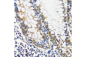 Immunohistochemistry of paraffin-embedded human colon using CCDC124 antibody  at dilution of 1:100 (40x lens). (CCDC124 Antikörper  (AA 1-223))