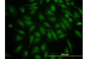 Image no. 1 for anti-Phosphoinositide 3-kinase Regulatory Subunit 4 (PIK3R4) (AA 1259-1359) antibody (ABIN599234) (PIK3R4 Antikörper  (AA 1259-1359))
