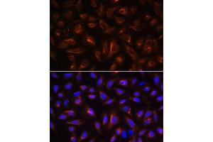 Immunofluorescence analysis of U-2 OS cells using B antibody (ABIN6130859, ABIN6137109, ABIN6137110 and ABIN6220869) at dilution of 1:100. (ARL13B Antikörper  (AA 1-240))