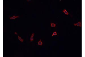 ABIN6269379 staining PC12  cells by IF/ICC. (STX1A Antikörper  (N-Term))