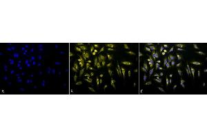Immunocytochemistry/Immunofluorescence analysis using Rabbit Anti-KDEL Polyclonal Antibody (ABIN863187 and ABIN863188). (KDEL Antikörper)