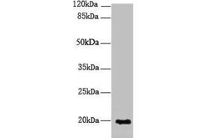 Western blot All lanes: NUDT11 antibody at 2 μg/mL + U251 whole cell lysate Secondary Goat polyclonal to rabbit IgG at 1/10000 dilution Predicted band size: 19 kDa Observed band size: 19 kDa (NUDT11 Antikörper  (AA 1-164))