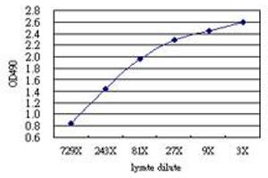 C4BPB (Human) Matched Antibody Pair