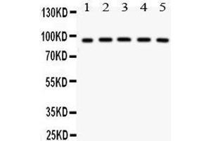 Anti- NR3C1 antibody, Western blotting All lanes: Anti NR3C1  at 0.