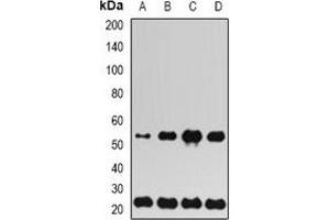Western blot analysis of UBE2H expression in SW480 (A), SKOV3 (B), mouse liver (C), rat lung (D) whole cell lysates.