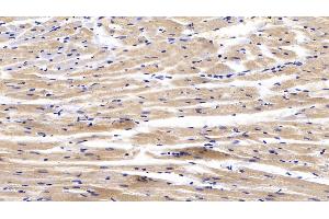 Detection of CTGF in Rabbit Cardiac Muscle Tissue using Polyclonal Antibody to Connective Tissue Growth Factor (CTGF) (CTGF Antikörper  (AA 118-388))