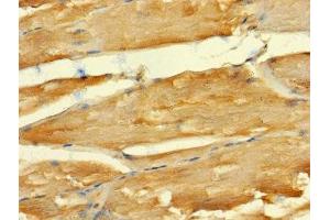 Immunohistochemistry of paraffin-embedded human skeletal muscle tissue using ABIN7143040 at dilution of 1:100 (ABLIM2 Antikörper  (AA 222-521))