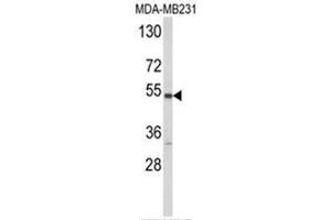 Western blot analysis of CYP2A13 Antibody (C-term) in MDA-MB231 cell line lysates (35ug/lane). (CYP2A13 Antikörper  (C-Term))