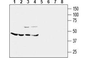 Western blot analysis of mouse brain membrane (lanes 1 and 5), rat cerebellum (lanes 2 and 6), rat lung (lanes 3 and 7) and rat kidney (lanes 4 and 8) lysates: - 1-4. (CRHR2 Antikörper  (Extracellular))