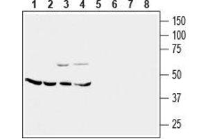 Western blot analysis of mouse brain membrane (lanes 1 and 5), rat cerebellum (lanes 2 and 6), rat lung (lanes 3 and 7) and rat kidney (lanes 4 and 8) lysates: - 1-4. (CRHR2 Antikörper  (Extracellular, N-Term))