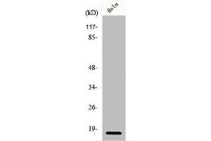 Western Blot analysis of HeLa cells using p15 Polyclonal Antibody (CDKN2B Antikörper  (C-Term))