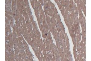 Detection of SHBG in Rat Cardiac Muscle Tissue using Monoclonal Antibody to Sex Hormone Binding Globulin (SHBG) (SHBG Antikörper  (AA 222-358))