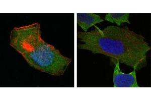 Confocal immunofluorescence analysis of HepG2 (left) and L-02 (right) cells using GSTP1 antibody (green). (GSTP1 Antikörper)