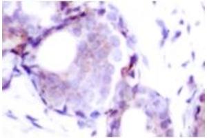Image no. 1 for anti-Myc Proto-Oncogene protein (MYC) (pSer373) antibody (ABIN318072) (c-MYC Antikörper  (pSer373))