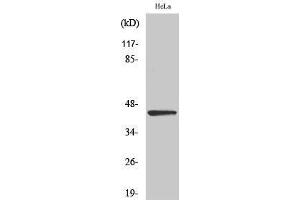 Western Blotting (WB) image for anti-Endonuclease VIII-Like 1 (NEIL1) (C-Term) antibody (ABIN3185815) (NEIL1 Antikörper  (C-Term))