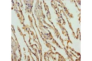 Immunohistochemistry of paraffin-embedded human lung tissue using ABIN7149965 at dilution of 1:100 (FMO5 Antikörper  (AA 1-285))