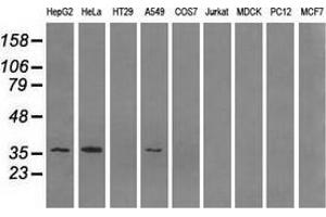 Western blot analysis of extracts (35 µg) from 9 different cell lines by using anti-AKR1A1 monoclonal antibody. (AKR1A1 Antikörper)