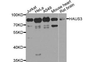 Western blot analysis of extracts of various cell lines, using HAUS3 antibody (ABIN5974538) at 1/1000 dilution. (HAUS3 Antikörper)