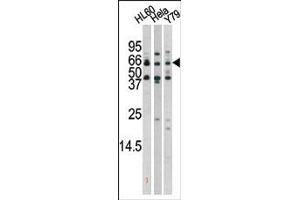 Image no. 2 for anti-RAD9 Homolog A (S. Pombe) (RAD9A) (pSer272) antibody (ABIN358200) (RAD9A Antikörper  (pSer272))