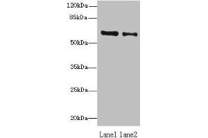 Western blot All lanes: ZNF626 antibody at 10 μg/mL Lane 1: HepG2 whole cell lysate Lane 2: Raji whole cell lysate Secondary Goat polyclonal to rabbit IgG at 1/10000 dilution Predicted band size: 61, 53, 11 kDa Observed band size: 61 kDa (ZNF626 Antikörper  (AA 1-92))
