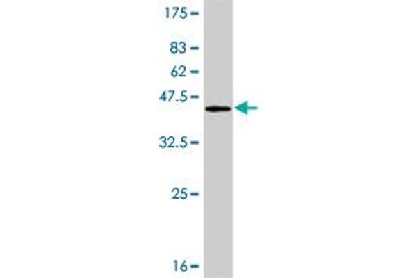 Plakophilin 4 Antikörper  (AA 12-110)