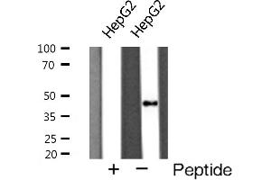 Western blot analysis of Cathepsin D expression in HepG2 cells (Cathepsin D Antikörper  (C-Term))