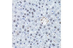 Immunohistochemistry of paraffin-embedded rat liver using C/EBPB Rabbit pAb (ABIN6134025, ABIN6138382, ABIN6138383 and ABIN6213964) at dilution of 1:100 (40x lens). (CEBPB Antikörper  (AA 150-250))