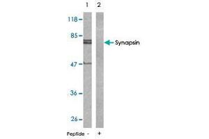 Western blot analysis of extract from mouse brain tissue using Synapsin polyclonal antibody  . (SYN1 Antikörper)