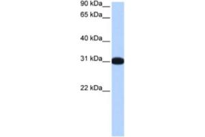 Western Blotting (WB) image for anti-Muscleblind-Like 2 (MBNL2) antibody (ABIN2463438) (MBNL2 Antikörper)