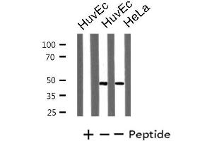 Western blot analysis of extracts from HuvEc/HeLa cells, using LHX1 antibody. (LHX1 Antikörper  (Internal Region))