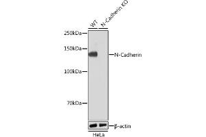 Western blot analysis of extracts from wild type (WT) and N-Cadherin knockout (KO) HeLa cells, using N-Cadherin antibody (ABIN7265999) at 1:1000 dilution. (N-Cadherin Antikörper)