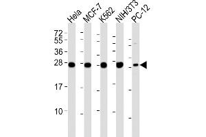 Lane 1: HeLa Cell lysates, Lane 2: MCF-7 Cell lysates, Lane 3: K562 Cell lysates, Lane 4: NIH/3T3 Cell lysates, Lane 5: PC-12 Cell lysates, probed with IF4E (1504CT774. (EIF4E2 Antikörper)