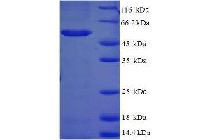 SDS-PAGE (SDS) image for Aldo-keto Reductase Family 1, Member C2 (AKR1C2) (AA 1-323), (full length) protein (His-SUMO Tag) (ABIN5709029)