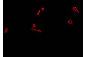 ABIN6273452 staining A549 cells by IF/ICC. (CD63 Antikörper  (Internal Region))