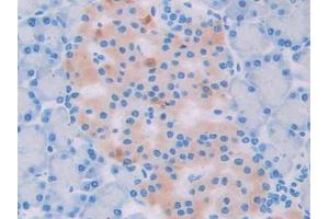 DAB staining on IHC-P; Samples: Rat Pancreas Tissue (UCP2 Antikörper  (AA 99-216))