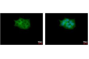 ICC/IF Image SCAP2 antibody [C2C3], C-term detects SKAP2 protein at cytoplasm by immunofluorescent analysis. (SKAP2 Antikörper  (C-Term))