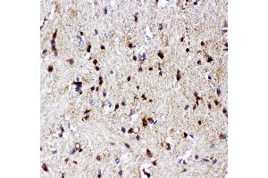 Anti- p73 antibody, IHC(P) IHC(P): Rat Brain Tissue (Tumor Protein p73 Antikörper  (AA 1-198))