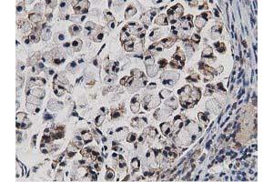 Immunohistochemistry (IHC) image for anti-Transforming, Acidic Coiled-Coil Containing Protein 3 (TACC3) antibody (ABIN1498095)