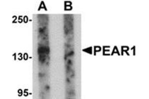 Western blot analysis of PEAR1 in rat kidney tissue lysate with PEAR1 antibody at 1 μg/ml in (A) the absence and (B) the presence of blocking peptide. (PEAR1 Antikörper  (C-Term))