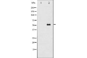 Western blot analysis of Smad2 expression in 293 whole cell lysates,The lane on the left is treated with the antigen-specific peptide. (SMAD2 Antikörper  (Internal Region))