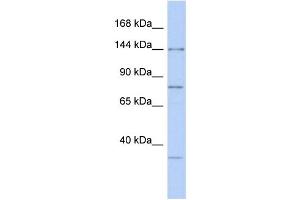 WB Suggested Anti-RNASEN Antibody Titration:  0. (DROSHA Antikörper  (Middle Region))