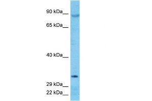Host:  Rabbit  Target Name:  DJC16  Sample Type:  PANC1 Whole Cell lysates  Antibody Dilution:  1. (DNAJC16 Antikörper  (N-Term))